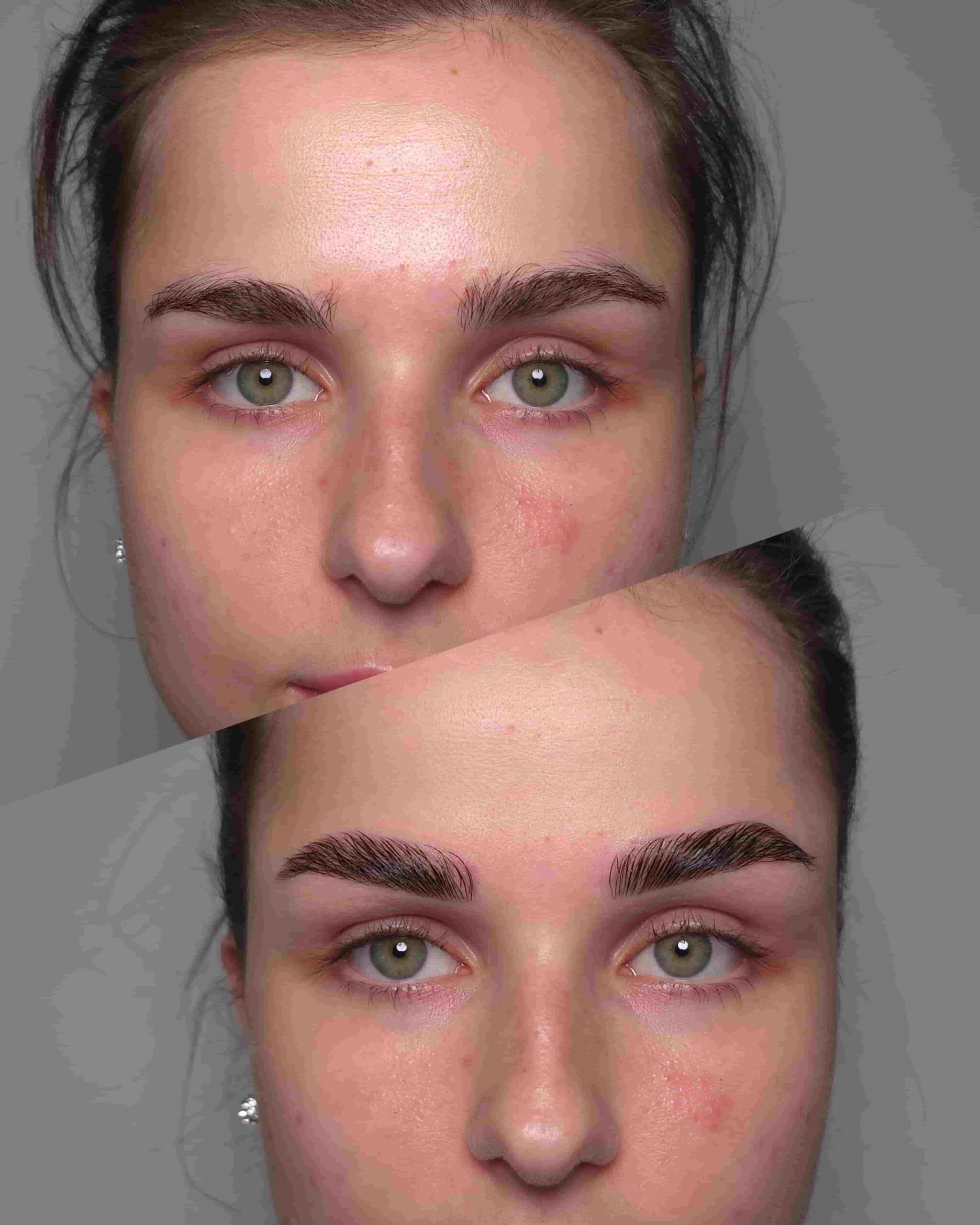 Kobieta podczas profesjonalnej pielęgnacji twarzy